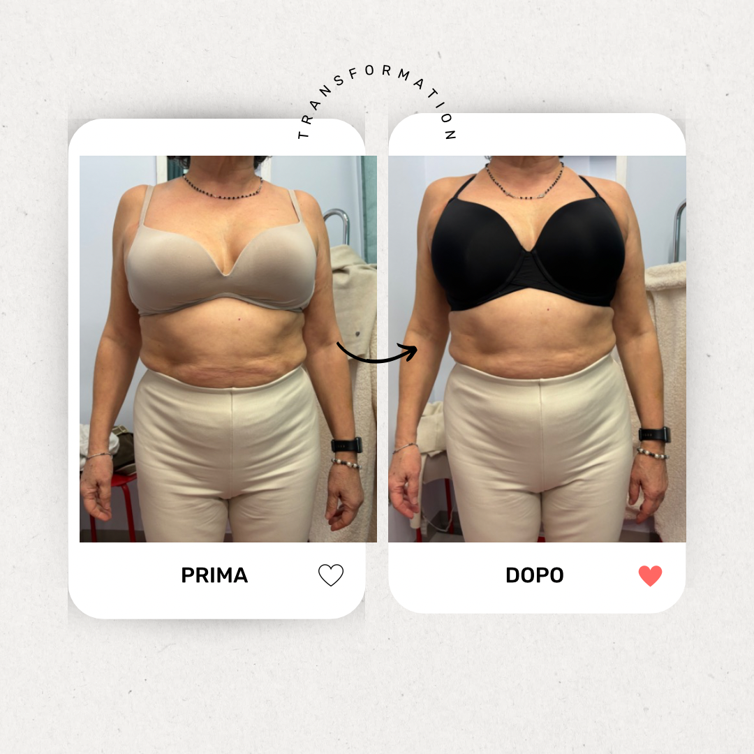 CONSULENZA BRA FITTING NEGOZIO A VERONA SOLO REGGISENI